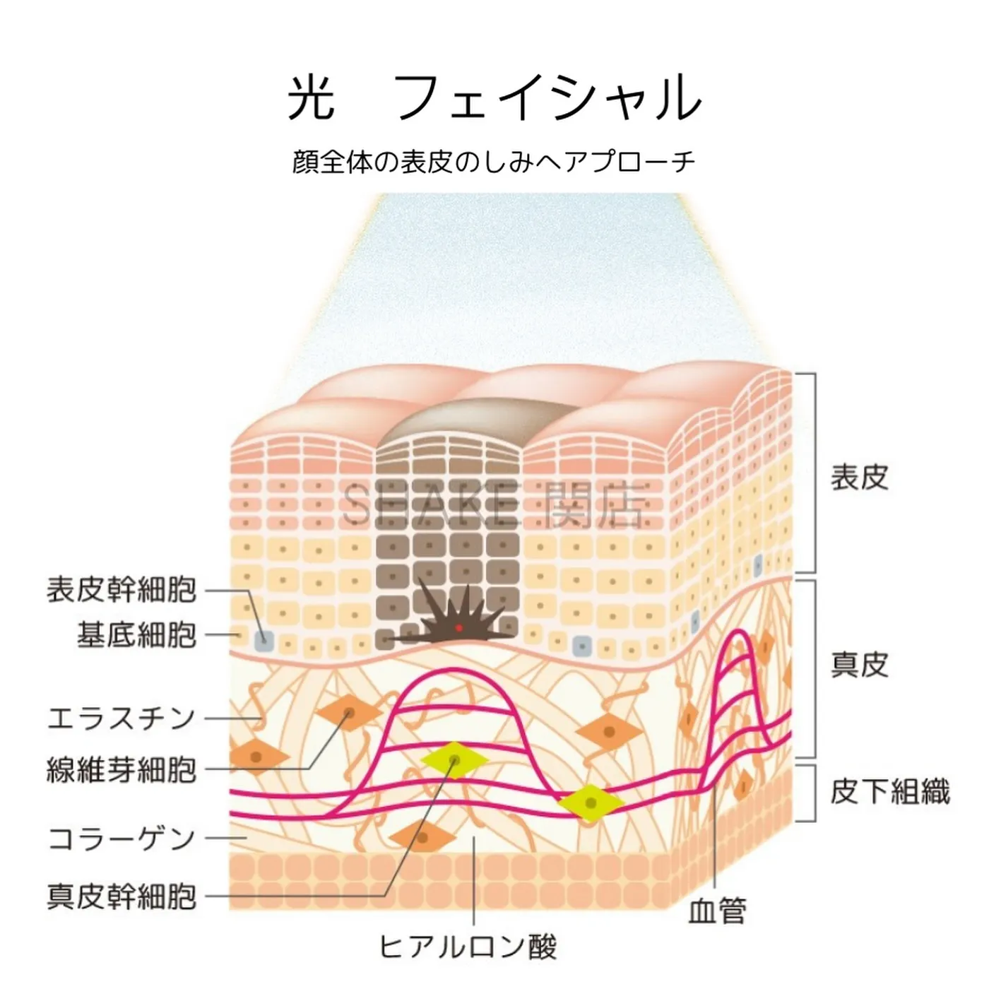 光フェイシャルエステの最大のメリットは、